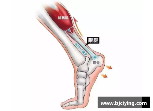 创世大发官网韧带断裂：运动员的隐形威胁